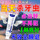 蟲牙蛀牙爛牙專用的藥防蛀牙膏蛀牙洞i修復齲齒成人兒童黑線清理 特效三盒裝【一周期】買二送一