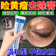 修正眼瞼黃瘤去眼皮黃斑瘤去除眼角瞼黃疣眼部專用膏藥去除神器藥膏 單盒裝【蛋白軟膏】
