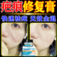 福隆藤原去疤痕修復(fù)凝膠醫(yī)院專用去疤膏兒童擦傷摔傷疤痕增生凸起去除疙瘩 一盒裝【疤痕克星】