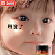 兒童祛斑膏小孩專用臉部有雀斑醫(yī)煙用酰胺凝膠正品淡化黑色素霜非藥臉部淡斑祛斑淡化遺傳曬斑美白護(hù)膚品女童 377淡化雀斑黑色素曬斑護(hù)膚霜