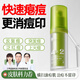 鮮一祛痘精華液煙酰胺凝膠去痘痘和痘印去閉口粉刺痘疤痘坑修護(hù)男女