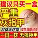 灰指甲100%專用的藥視覺特效重度灰指甲藥膏指甲真菌感染脫甲壞甲亮甲增厚真菌感染根藥治硝酸咪康唑乳膏 1盒裝【建議多盒用藥 發(fā)貨特效】重度灰指甲