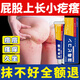 屁股癢長(cháng)痘痘久坐濕疹坐瘡起疙瘩坐板瘡藥膏紅腫瘙癢臀部止癢膏 1盒裝【專(zhuān)冶屁股痘】 屁股上出汗起小疙瘩藥