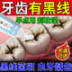 藤石制藥牙菌斑去牙齒黑線(xiàn)黑漬牙窩溝可搭牙膏防蛀去黑線(xiàn)牙縫發(fā)黑去黑斑HW 送牙刷【單盒裝】牙齒黑線(xiàn)