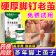 老繭軟化膏繭子去除器腳底厚繭死皮角質(zhì)腳趾腳釘雞眼關(guān)節繭軟化腳后跟硬皮溶解角質(zhì)足部腳繭膏 1盒【免費試用】體驗裝