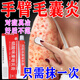 手臂毛囊炎藥膏手臂上的小疙瘩胳膊毛孔堵塞疏通毛囊祛痘雞皮膚紅點(diǎn)黑點(diǎn)痘印淡化消除皮膚用藥硝酸咪康唑乳膏 1盒【手臂毛囊炎專(zhuān)用藥】100%主圖視覺(jué)特效