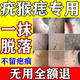 鑫璽垚去除疣體藥膏100%進(jìn)口扁平疣絲狀疣瘊靈去除脖子小肉粒扁平疣刺猴 液一盒【專攻疣刺瘊 肉?！?去疣神器去疣膏點(diǎn)疣去疣水點(diǎn)痣