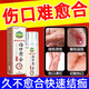 傷口快速愈合藥外傷創(chuàng)傷消炎割傷皮外傷長(zhǎng)肉快的結(jié)痂促進(jìn)生肌噴霧 促進(jìn)傷口愈合【60ml/一盒裝】