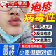 緹藏堂嘴唇皰疹嘴角嘴巴特藥上火起泡藥膏外用爛口角周皮炎專(zhuān)用膿瘡潰爛 特效嘴唇上火起泡膏嘴巴皰疹