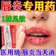 唇炎專用藥慢性嘴唇干裂醫(yī)用級(jí)唇炎藥膏兒童嘴唇修復(fù)膏唇膜保濕滋潤嘴唇防嘴角開裂嘴唇干起皮硝酸咪康唑乳膏 1盒【嘴唇干裂起皮唇炎】