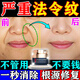 素秀臣氏法令紋睡覺專用提拉貼去除神器緊致消除皺抬頭川字嘴角八字紋面霜 50g 1盒【體驗裝】