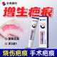 本桑制藥?kù)畎谈囔畎毯坌迯?fù)凝膠醫(yī)用硅酮疤痕增生凸起去除疙瘩手術(shù)燙傷通用 3盒周期裝【只要2盒價(jià)格】