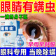 眼博士一滴除螨蟲】眼睛除螨洗滴眼液干癢充血過敏茶樹油濕巾清潔眼部藥 1瓶裝【特效i發(fā)貨】