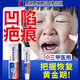 DR.AVIN兒童凹陷疤痕生長(zhǎng)修復(fù)填充凝膠祛疤膏痘坑修復(fù)凹洞生長(zhǎng)因子SC 【單盒裝】凹陷疤痕專用凝膠