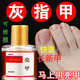 【亮甲官方旗艦店】亮甲亮甲快速長(cháng)新甲灰指甲祛根專(zhuān)用液治灰指甲藥液增厚甲大藥房直發(fā) [療程裝]3瓶裝