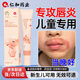 仁和兒童唇膏唇炎保濕口周炎爛舔嘴角干裂脫皮男孩女童專(zhuān)用6-12歲藥膏 【應急舒緩紅點(diǎn)】唇周膏1支裝20g 唇炎潰破疼痛口角炎