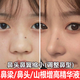 慕心姿坊 BEAUTY ADMIRE鼻梁增高瘦鼻子變高變挺增高塌挺鼻美鼻神器翹瘦鼻頭縮小鼻翼精油 鼻部塑顏精華液【一瓶裝】