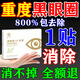 儷之康眼霜祛眼袋黑眼圈去除男士重度黑色素神器眼膜眼貼熬夜克星女 1盒【快速見效】