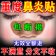 北京協(xié)和醫(yī)學院鼻炎噴劑霧鼻炎貼專用過敏性鼻竇炎治鼻塞通鼻根神器專用兒童成人 一盒裝【醫(yī)用級鼻炎貼】 蒼耳子油純中藥穴位貼