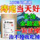 喬記痔瘡坐浴藥中藥包熏洗肛周去斷肉球治內(nèi)外混合痔瘡根專用膏藥洗液 買3送2【根冶老痔瘡】五盒