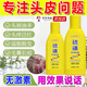 洗發(fā)水毛囊炎專(zhuān)用醫用級去屑止癢頭螨蟲(chóng)頭部頭皮癢有疙瘩溢脂性皮炎改善頭皮馬拉色抑菌真菌感染洗發(fā)劑 買(mǎi)三送一【免費試用】發(fā)4盒