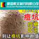 DR.AVIN德國戴文制藥有限公司】痘坑修復(fù)凹洞痘印痘疤凹坑疤痕修復(fù)凝膠HW 【兩盒優(yōu)惠裝】第二盒半價(jià)【店長推薦】