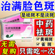 祛斑專用藥祛斑內(nèi)調(diào)中藥 化瘀祛斑膠囊內(nèi)調(diào)黃褐斑官方艦旗 黃褐斑內(nèi)調(diào)口服臉上長斑用【本店第一視覺特效】 3盒療程【滿臉黃褐斑】