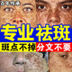 香草雨露祛斑霜美白淡化老年黃褐雀斑黑色素點(diǎn)斑專(zhuān)用水藥一夜消效果最好品 特效發(fā)：1盒【醫用級正品】 祛斑美白淡化老年黃褐雀斑黑色素