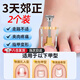 南京同仁堂甲溝炎矯正器嵌甲矯正器墊片神器腳趾甲專用指甲刀藥貼片長(zhǎng)在肉里 甲溝炎專用矯正器京【2個(gè)裝】 甲溝炎填充墊片剔甲器指甲剪