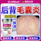 Dr.HillGod后背痘痘藥膏后背長痘痘毛囊炎專用前胸后背部膿包痤瘡祛痘專用特 一盒裝【德國品質 特效必備】 德國品牌非進口專用的醫(yī)藥級