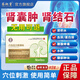 苗昶堂腎結(jié)石腎囊腫用膏藥貼腹部疼痛腎囊腫型穴位壓力刺激貼 【官方店】3盒裝XO【80%用戶選擇】