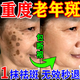 萊覽奧蓋祛斑霜美白淡化老年黃褐雀斑黑色素曬斑去祛斑男女士專(zhuān)用醫用正品 特效;一盒裝【日本進(jìn)口】 老人斑臉部手背效果最好的產(chǎn)品非中藥一夜消