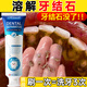 HIEUAILR胖東來牙垢牙結(jié)石專用去黃去牙漬去煙漬牙齒清潔器去除器搭牙膏