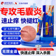淞町制藥毛囊炎膏頭部頭皮起疙瘩止癢雞皮膚膿包角化癥后背私處專(zhuān)用非藥