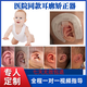 新生兒耳廓矯正器嬰兒耳朵矯正醫(yī)院同款耳畸形矯形器寶寶耳朵定型 右耳全套（定制方案） 透明