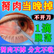 鄒潤安胬肉眼藥水眼睛去胬肉翼狀胬肉緩解異物感眼疲勞眼干眼澀滴眼液 買二送一【消除胬肉】