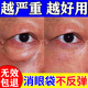 眼袋去除神器去眼袋男士專(zhuān)用眼袋貼眼霜嚴重中老年去眼袋淡化細紋 眼貼*3盒【浮腫大眼袋】療程裝