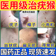 水楊酸軟膏去疣專用藥絲狀疣扁平疣脖子上頸部專用藥?kù)铕囵颖馄金嗳ゲ弊由系男∪饬ｌ铕嗵豬藥肉粒疙瘩去疣 2盒【脖子小肉粒 不好看影響美觀】店長(zhǎng)推薦