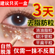 脂肪粒去除藥膏脂肪瘤專用特針效藥汗管瘤脂肪粒去除神器眼周專用去小顆粒脂肪粒專用特眼霜效藥維A酸乳膏 3盒【長(zhǎng)年頑固脂肪粒掉了又長(zhǎng)難消除】從跟消除不反覆