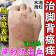達克寧腳氣藥止癢脫皮爛腳丫真菌感染治腳氣達克寧硝酸咪康唑乳膏腳臭腳氣藥止癢真菌感染皮膚用藥 非處方藥 3盒【長期反復(fù)嚴(yán)重腳氣 爛癢臭】療程裝 達克寧腳氣藥止癢脫皮爛腳丫真菌感染治腳氣