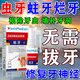 南京同仁堂蟲(chóng)牙蛀牙爛牙專(zhuān)用的藥防蛀牙膏蛀牙洞i修復齲齒成人兒童黑線(xiàn)清理 蛀牙噴劑
