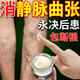 佩措琛克靜脈曲張舒膏藥貼蚯蚓腿治療血管堵塞疏通腿青筋凸起專(zhuān)用冷敷凝膠 進(jìn)口紅血絲藥膏：拍1發(fā)3【包疏通