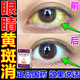 黃斑病變眼藥水眼白發(fā)黃眼睛渾濁明目滴眼液京東大藥房正品去黃干澀紅血絲眼藥水 1盒【建議多盒】