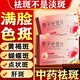 祛斑專用藥內(nèi)調(diào)中藥第女性男士一名臉上有斑去斑點(diǎn)斑黃褐斑雀斑老年斑黑斑點(diǎn)黑色素口服藥景天祛斑片正品 1盒裝【國(guó)藥準(zhǔn)字 非處方藥】