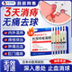 本安制藥痔瘡膏去肉球內(nèi)外混合痔瘡專用卡波姆消痔凝膠栓肛門瘙癢非藥3盒