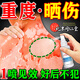 內(nèi)廷上用曬后曬傷修復(fù)膏藥皮膚屏障受損泛紅日光性皮炎紫外線過敏脫皮止癢 一盒【曬傷專用噴霧】