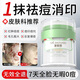 BAILUHUI祛痘膏祛痘坑修復淡化青春痘祛痘護膚品學(xué)生舒緩保濕乳面霜