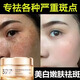 麗康源377美白祛斑霜熊果苷煙酰胺淡斑 淡化黑色素去雀斑黃褐斑提亮膚色 377進(jìn)口美白祛斑霜30g 一瓶