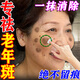 千紹方老年斑臉部手背祛斑專(zhuān)用霜去老人斑去斑去黑色素美i白祛斑霜面部 強效特效霜:一盒裝【醫用正品】