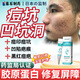 藤石制藥去痘印痘疤祛痘坑修復(fù)凹洞生長(zhǎng)因子男士淡化消填充醫(yī)用凹陷疤痕YZ 兩盒裝 第二盒半價(jià)【基礎(chǔ)裝】